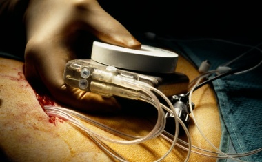 Sensorik in Implantaten