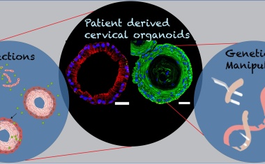 Große Fortschritte dank Mini-Organen