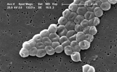 Wie aus einem harmlosen Umweltbakterium der gefürchtete Krankenhauskeim Acinetobacter baumannii wurde