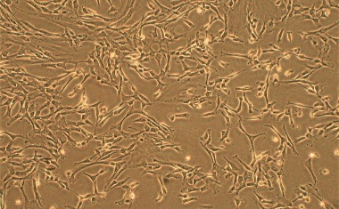 Dank Nabelschnur-Stammzellen: Erstmals Therapieerfolg bei schwerem Lungenhochdruck