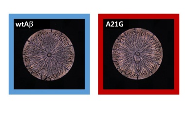 Früherer Alzheimer-Nachweis