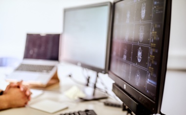 Effiziente KI-Technologie zur Analyse von MRT-Daten