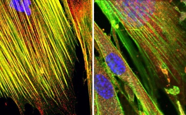 Verräterische „Spuren“ am Zellskelett lösen Virus-Alarm aus