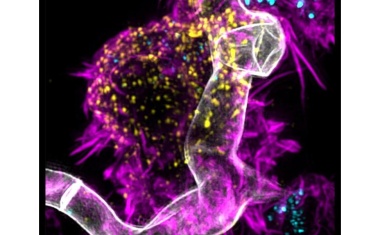 Neue Immuntherapie für Pilzinfektionen der Lunge