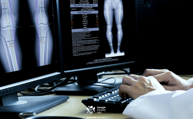 KI für Knochenerkrankungen in deutscher Top-Klinik eingesetzt