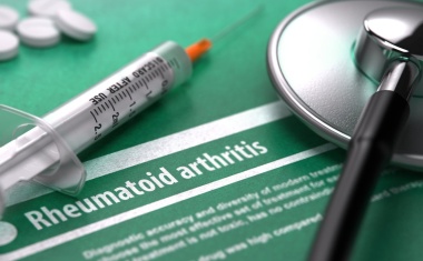 Geschlechtsspezifische Unterschiede im Krankheitsverlauf von rheumatoider Arthritis