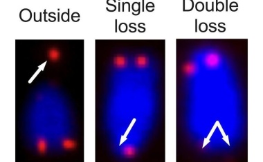 Schlüssel zur fälschlichen Aktivierung des Immunsystems