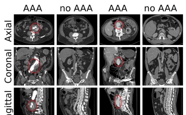 Wirtschaftsministerium fördert das Projekt DeepRAY