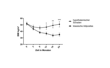Erfolg von Adipositas-OP hängt wesentlich vom Gehirn ab