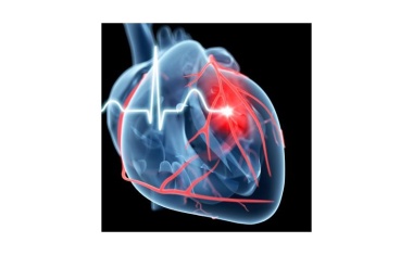 Ergebnisse der Strong-HF-Studie zeigen deutliche Vorteile für Patienten mit akuter Herzinsuffizienz