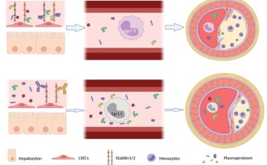 Neuer Ansatz für die künftige Behandlung der Atherosklerose