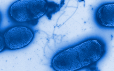 Protein in Schwarzarbeit macht Krankenhauskeim erst gefährlich