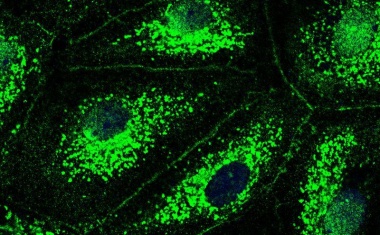 Mukoviszidose-Medikament könnte bei Lungenentzündungen helfen