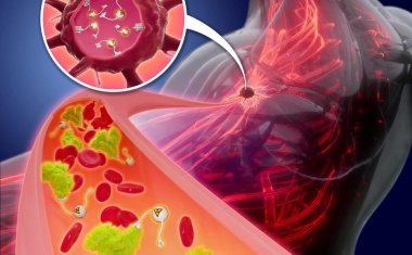 Alphastrahler für die Krebstherapie