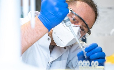 Long COVID Studie: Blutwerte zeigen Umprogrammierung von Immunzellen an