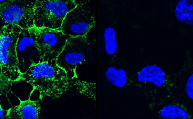 Zuckerbasierte Inhibitoren entwaffnen den Krankheitserreger Pseudomonas aeruginosa
