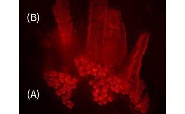 Neuartige Methode ermöglicht Genstudien zur Funktion und zu Erkrankungen der Darmschleimhaut