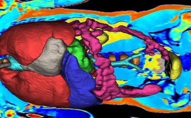 Sieben Millionen Euro für künstliche Intelligenz in der Bildgebung