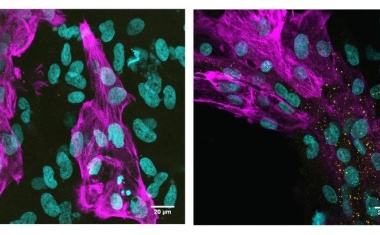 Herzmuskelzellen: Omicron-Subvariante BA.5 schädigt Kardiomyozyten stärker als BA.1