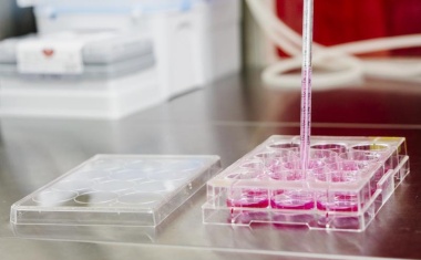 Neue Standards zur Quantifizierung des Hepatitis-B-Virus-Reservoirs in Leberzellen