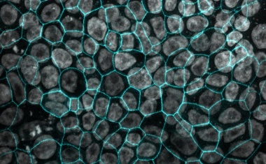 Neues Zellmodell für die menschliche Lunge