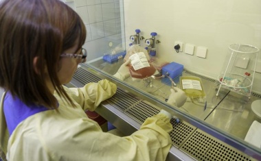 Akute Myeloische Leukämie: Zuerst Stammzelltransplantation oder Chemotherapie?