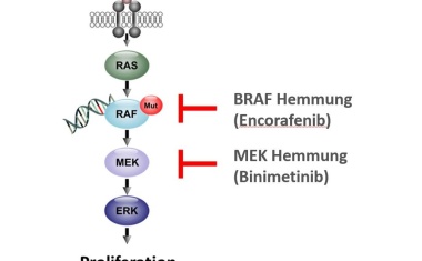 Personalisierte Therapie beim Multiplen Myelom
