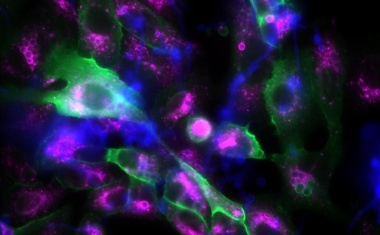 Pilzsporen kidnappen Lungenzellen