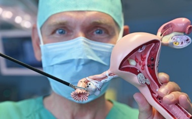 Eileiter-Entfernung als Vorbeugung gegen Eierstockkrebs akzeptiert