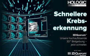 Die Zeichen stehen auf 3D-Mammografie