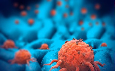 Metastasenbildung am Computer simulieren