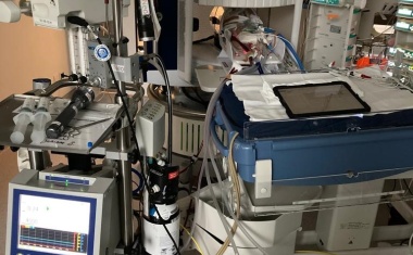 Mobiles MRT für pädiatrische ECMO-Patienten