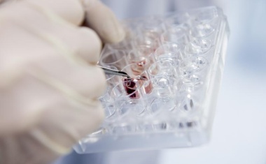 Kooperativ und nachhaltig - die klinische Forschungsplattform des DZHK