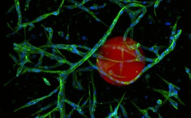 Modulare Mikrogel-Plattform für Diagnose, Therapie und realistische Krankheits- und Gewebemodelle