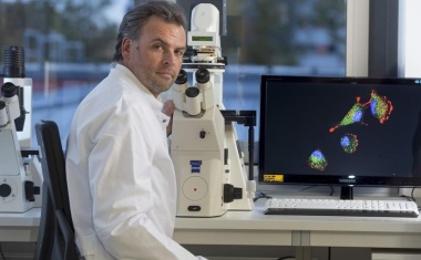 Blockiertes Protein macht aggressive Hirntumoren sensibler für Strahlen- und Chemotherapie