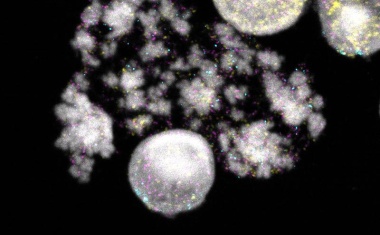 Wie sich Krebsgene selbständig machen