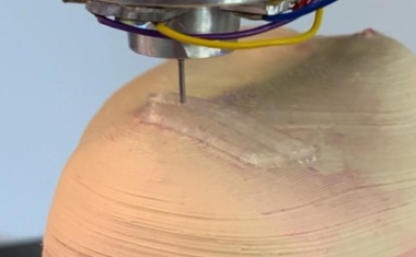 Personalisierter Knorpelersatz gegen Knieleiden