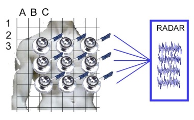 Berührungslos Atmung und Herzschlag messen