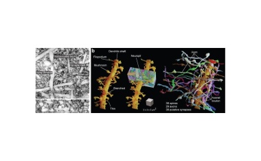 Lioness: „Live“-Einblick in die Komplexität von Gehirn-Gewebe
