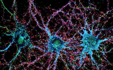 Neurologische Autoimmunerkrankungen im Zentrum