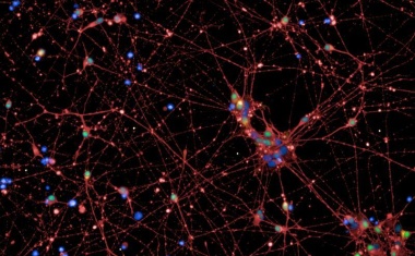 Nicht nur Lebensstil und Gene: Weiterer Einflussfaktor für Übergewicht entdeckt