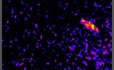 Multiple Sklerose: Verhängnisvolle Immunzell-Aktivierung im Darm sichtbar gemacht