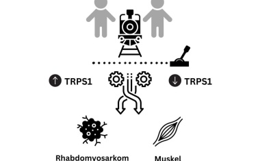 Neuartiger Behandlungsansatz für Weichteiltumore