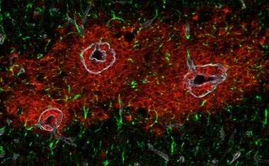 Sekretomics deckt Rätsel um Blut-Hirn-Schranke auf