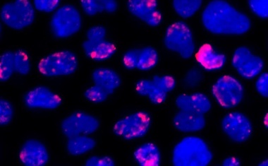 Grundlegend neuer Mechanismus der Blutkrebsbiologie entdeckt
