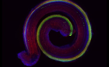 Erkenntnisse ebnen den Weg für Therapien gegen Gehörverlust