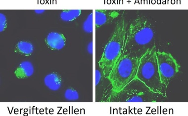 Herzmedikament wirkt gegen Krankenhauskeim