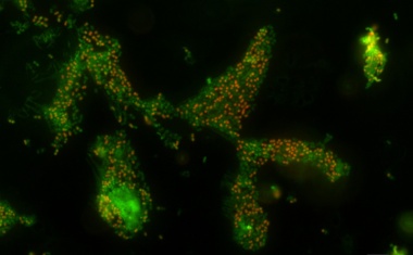 Krankenhauskeim im Dornröschenschlaf