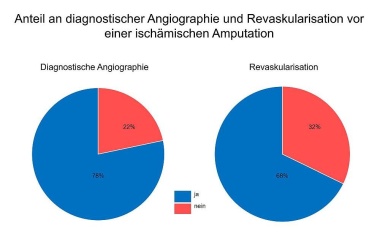 Viele Amputationen bei Patienten mit kritischer Ischämie könnten verhindert werden