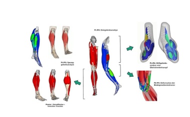 Patientengerechte Implantate durch Simulation an virtuellen Menschmodellen